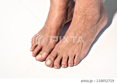 Feet of a caucasian adult woman on white background. Feet of a caucasian adult woman on white background. 118052729