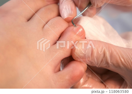 Pedicurist is cleaning nails from dry skin and dirt on toes using metal stick. 118063580
