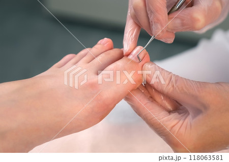 Pedicurist is cleaning nails from dry skin and dirt on toes using metal stick. Pedicurist is cleaning nails from dry skin and dirt on toes using metal stick. 118063581