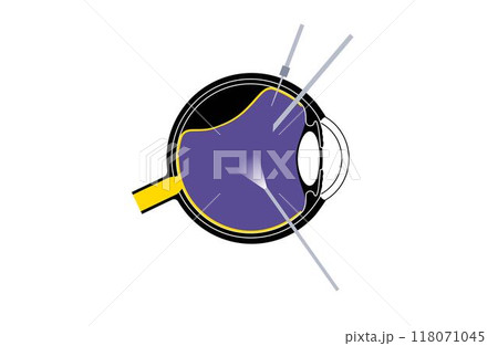 Vitrectomy surgical poster 118071045