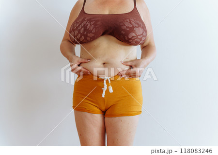 unrecognizable woman showing fat belly with saggy skin unrecognizable woman showing fat belly with saggy skin 118083246