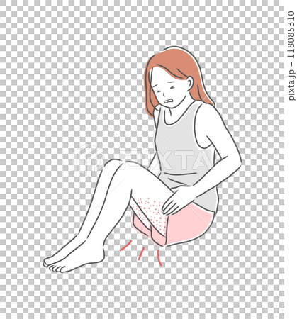 腳部皮膚粗糙的女人插畫素材 118085310