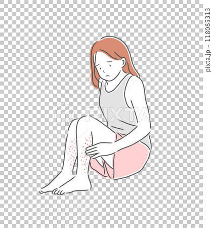 腳部皮膚粗糙的女人插畫素材 腳部皮膚粗糙的女人插畫素材 118085313