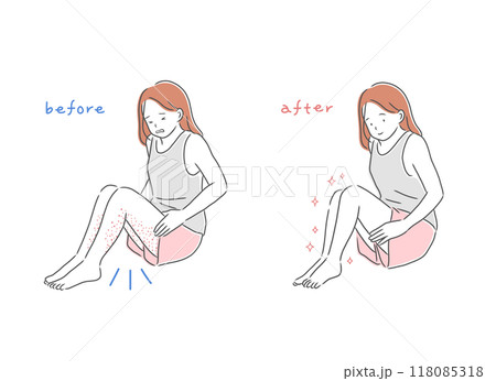 足の肌荒れに悩む女性と肌がきれいな女性のイラスト素材 118085318