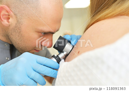 A dermatologist oncologist uses a dermatoscope to examine moles and birthmarks on the patient's body. Melanoma Day, Skin Cancer 118091363