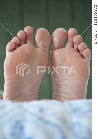 close up of young man dry feet on bed , close up of young man dry feet on bed , 118105272