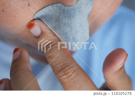 A woman uses a pore strip in her skincare routine to maintain appearance and promote skin health A woman uses a pore strip in her skincare routine to maintain appearance and promote skin health 118105278