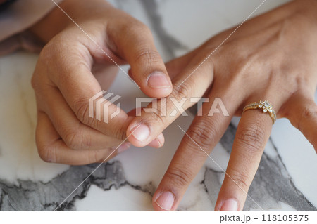 Young women hands suffering pain in finger 118105375