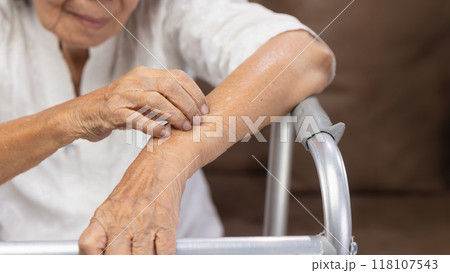 Elderly woman itchy and scratching arm because dry skin. Elderly woman itchy and scratching arm because dry skin. 118107543