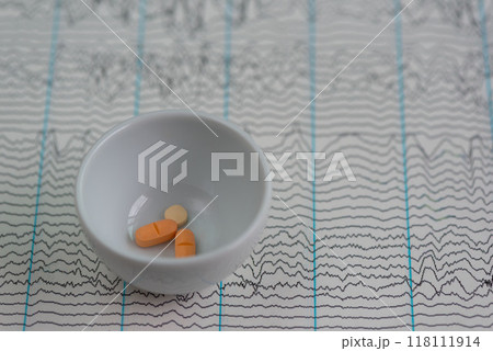 Antiepileptic drugs on EEG graph 118111914