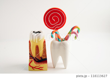 Tooth decay with sweet sugar candy, bad food for dental health care. Tooth decay with sweet sugar candy, bad food for dental health care. 118113627