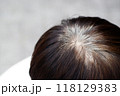 Back view of young people premature gray hair, showing black hoary hair roots on head change to senior old man outdoor. 118129383