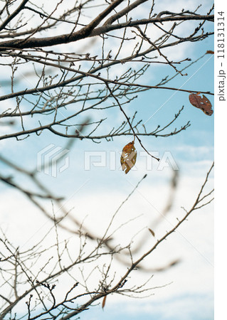 今にも落ちそうな歯 118131314