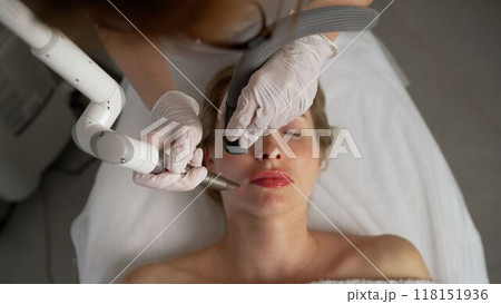 A woman undergoes a dermatological procedure in the operating room. Serene lady undergoing skin treatment. Close-up of a woman undergoing a cosmetic procedure. A woman undergoes a dermatological procedure in the operating room. Serene lady undergoing skin treatment. Close-up of a woman undergoing a cosmetic procedure. 118151936