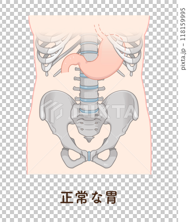 胃下垂、胃、胃アトニー、STAGE OF GASTROPTOSISのイラスト素材