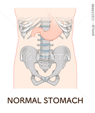 胃下垂、胃、胃アトニー、STAGE OF GASTROPTOSIS 胃下垂、胃、胃アトニー、STAGE OF GASTROPTOSIS 118159996