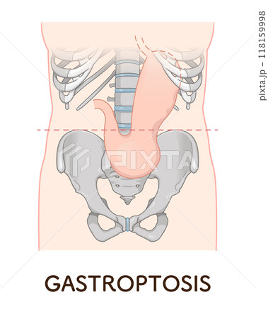 絵画 In my stomach My Stomach - Bearport Publishing
