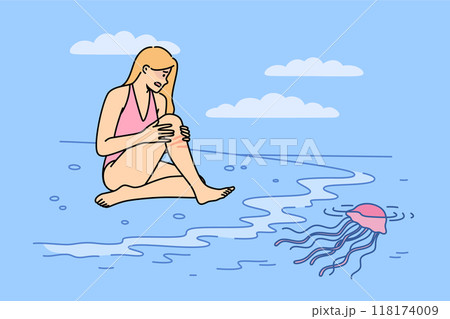 Jellyfish left burn on woman body after coming into contact with underwater in tropical ocean 118174009