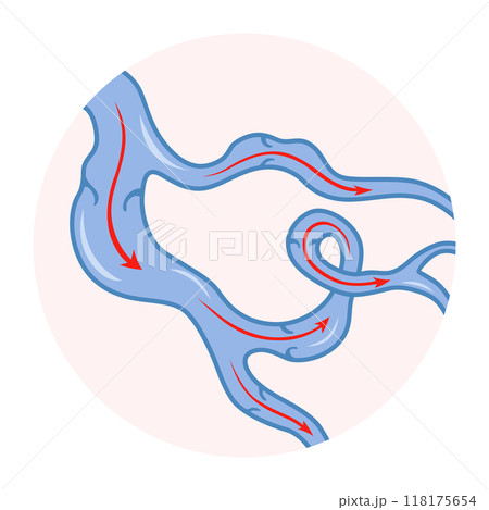 Varicose veins. Blue blood vessel visible through the skin. Vascular disease diagnostic and treatment. Venous insufficiency medical 118175654