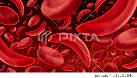 Sickle Cell Disease 118185846