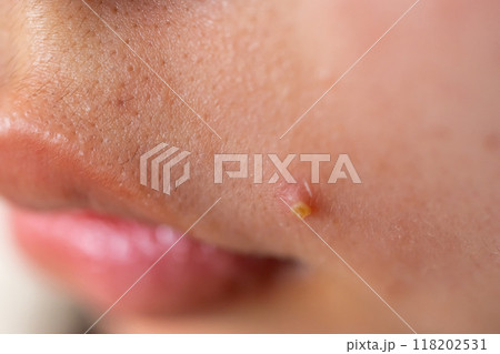 15 years old 118202531