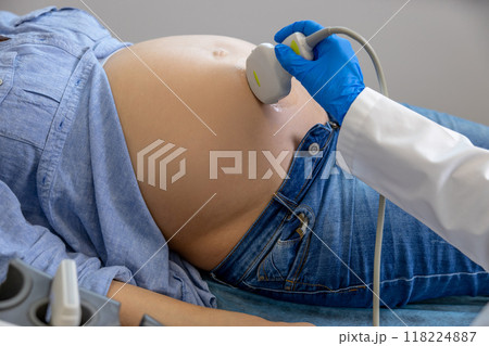 Close up of doctors hand with sensor doing ultrasonography to a pregnant woman Close up of doctors hand with sensor doing ultrasonography to a pregnant woman 118224887