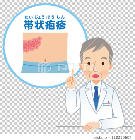 醫生解釋帶狀皰疹 醫生解釋帶狀皰疹 118230604