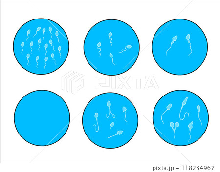 Vector isolated illustration of sperm pathologies. Spermogram. Sperm defects. Defects of the sperm head. Sperm motility. Vector isolated illustration of sperm pathologies. Spermogram. Sperm defects. Defects of the sperm head. Sperm motility. 118234967