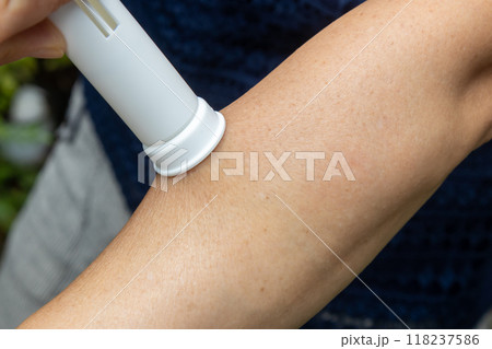 ポイズンリムーバーで虫刺されの毒を吸う女性の手元 118237586