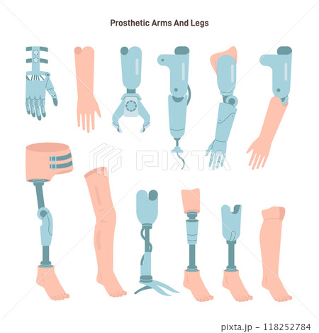 Artificial limbs types set. Prosthesis for arm and legs. Biotechnology for disabled people asisstance. Flat vector illustration 118252784