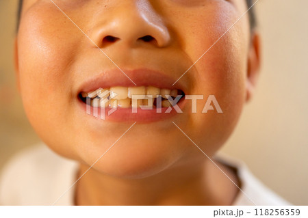 10 years old 10 years old 118256359