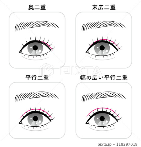 二重まぶたの種類 二重まぶたの種類 118297019