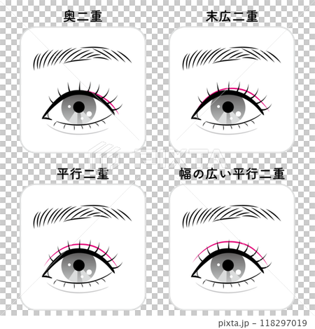 雙眼皮的類型 118297019