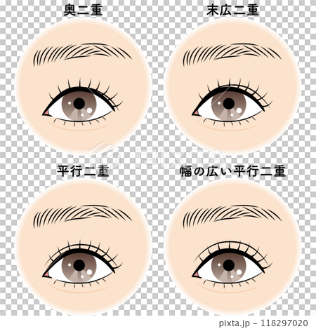 Types of double eyelids 118297020
