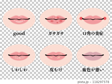 唇のトラブルセット 唇のトラブルセット 118297378