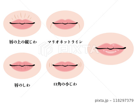 口元のシワ 口元のシワ 118297379