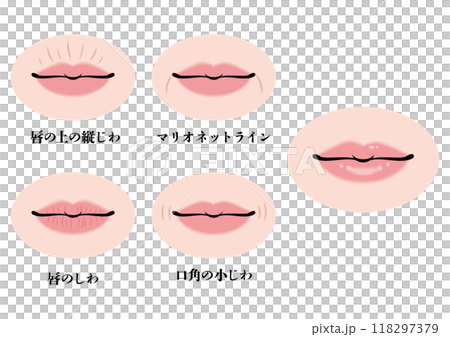 口元のシワ 口元のシワ 118297379