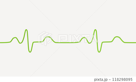 ECG of bundle branch block, 3D illustration 118298095