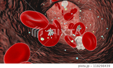 Erythrocytes with plastic microparticles, 3D illustration 118298439