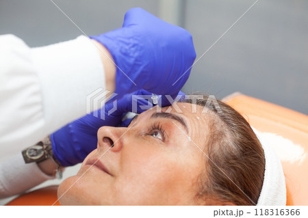 Dermatologist applying Botulinum toxin to a middle age female patient. Aesthetic medicine. 118316366