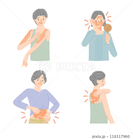 皮膚の病気:肌がかゆくてイライラするシニア女性イラストセット 皮膚の病気:肌がかゆくてイライラするシニア女性イラストセット 118317960