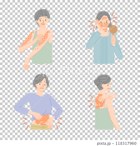 皮膚の病気:肌がかゆくてイライラするシニア女性イラストセット 皮膚の病気:肌がかゆくてイライラするシニア女性イラストセット 118317960