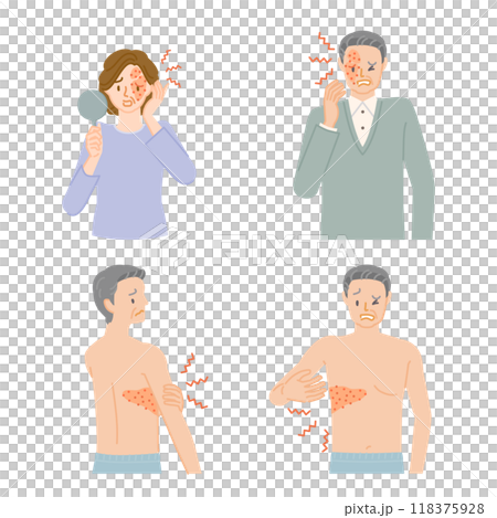 Shingles: illustration set of middle-aged men and women with pain, itching and swelling 118375928