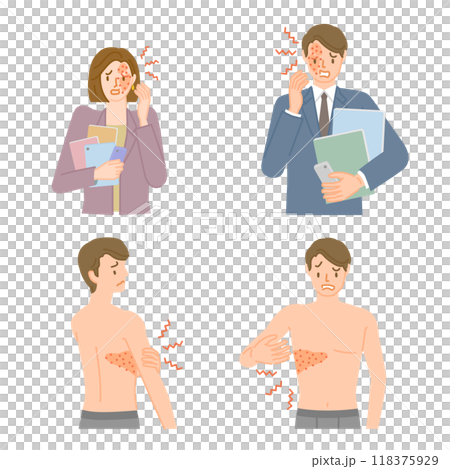 帶狀皰疹：男性和女性疼痛、搔癢和腫脹的插圖集 118375929