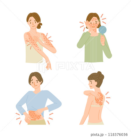 皮膚の病気:肌がかゆくてイライラする女性イラストセット 皮膚の病気:肌がかゆくてイライラする女性イラストセット 118376036