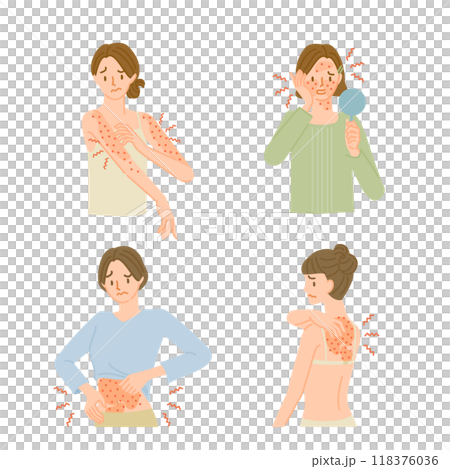 皮膚の病気:肌がかゆくてイライラする女性イラストセット 皮膚の病気:肌がかゆくてイライラする女性イラストセット 118376036