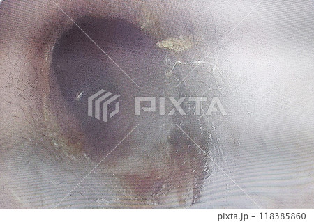 ear wax build up symptoms ear wax build up symptoms 118385860