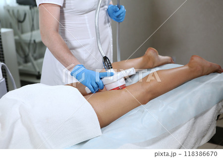 Radio frequency lifting of skin of legs.Hardware cosmetology. Body care. Ultrasonic cavitation procedure for body correction. Anti-cellulite therapy in beauty salon Radio frequency lifting of skin of legs.Hardware cosmetology. Body care. Ultrasonic cavitation procedure for body correction. Anti-cellulite therapy in beauty salon 118386670