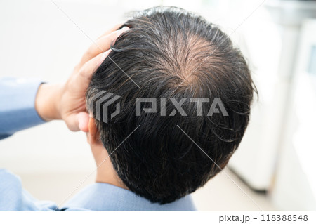 Bald in the middle head and begin no loss hair glabrous of mature Asian business smart active office man. Bald in the middle head and begin no loss hair glabrous of mature Asian business smart active office man. 118388548