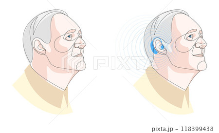 Senior man wearing hearing aid and hears well. Otolaryngology treatment concept. One line drawing of healthcare device, medicine technology. Vector illustration. 118399438